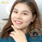 trong rang implant tai tphcm
