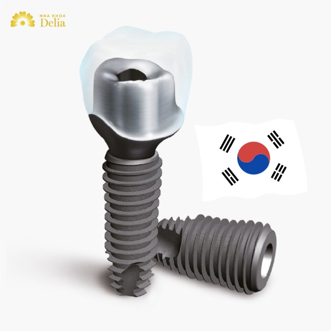 Trụ Implant Dio Hàn Quốc có cấu tạo và chức năng gì nổi bật?