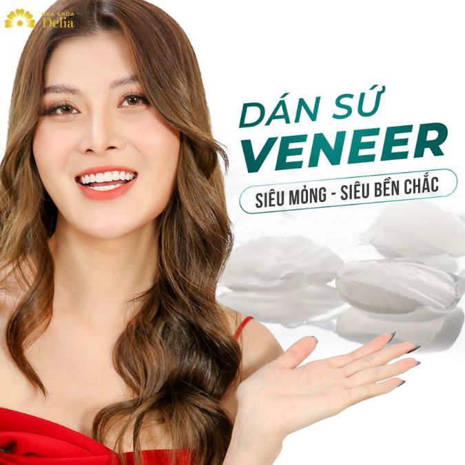 Dán sứ Veneer Emax giá bao nhiêu? Emax Veneer có tốt không?