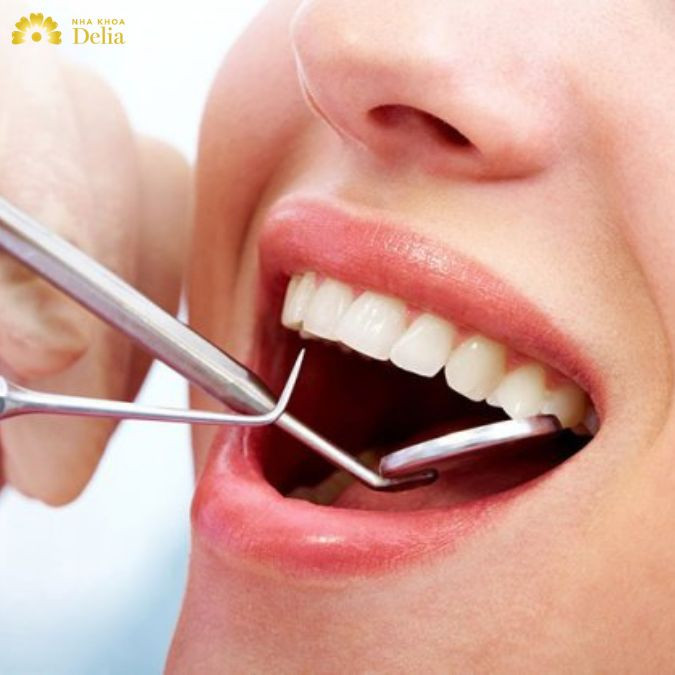 Giải đáp thắc mắc: Nhiều cao răng gây hôi miệng không? Biện pháp xử lý