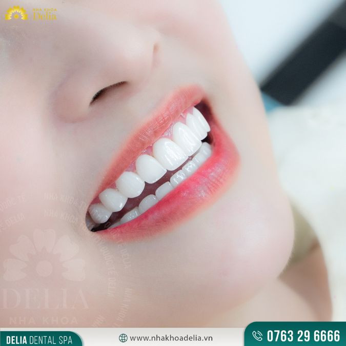 Compare porcelain crowns with metal and porcelain crowns with titanium