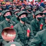 Mất răng có đi nghĩa vụ không