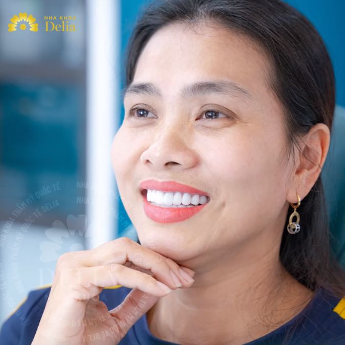 Chị Nguyễn Xuân review cải thiện RĂNG CỬA ĐEN chỉ 2 ngày