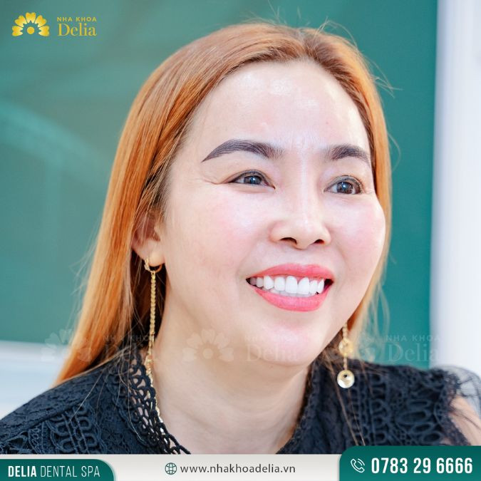 Răng cửa bị lung lay do đâu? Lung lay răng cửa nên làm gì?