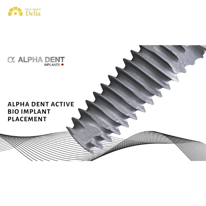 Trụ Implant Alphadent có tốt không? Đặc điểm nổi bật của trụ Implant Alphadent