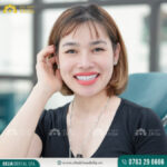 Chị Thu Hương - Thẩm mỹ 16 răng sứ Emax