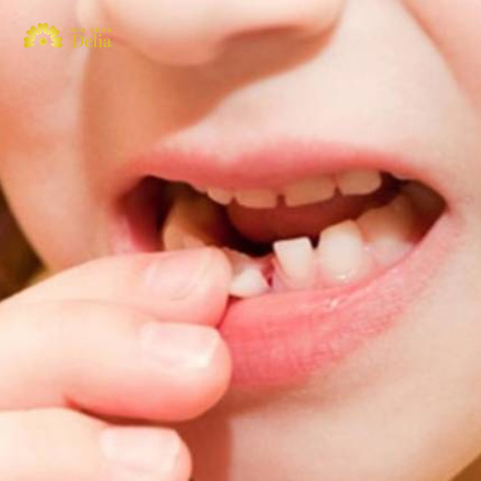 Răng sâu có tự rụng không? Hiểu đúng để chăm sóc răng miệng hiệu quả