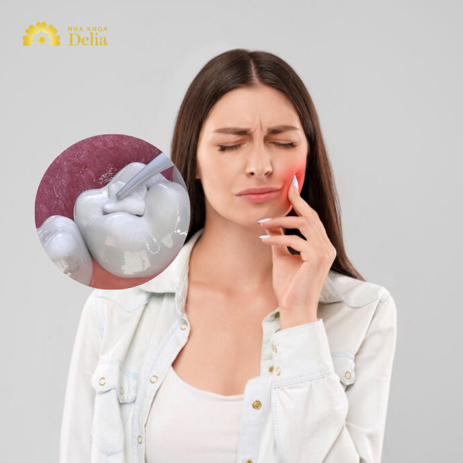 Trám răng sâu rồi mà vẫn đau nguyên nhân do đâu, xử lý như thế nào?