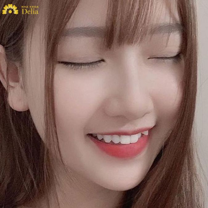 5 Tướng răng phú quý giàu sang hưởng phúc cả đời