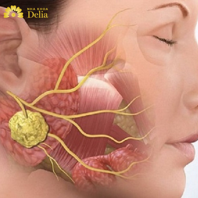 Dấu hiệu nhận biết khi bị đau quai hàm gần tai bên phải? Cách điều trị hiệu quả