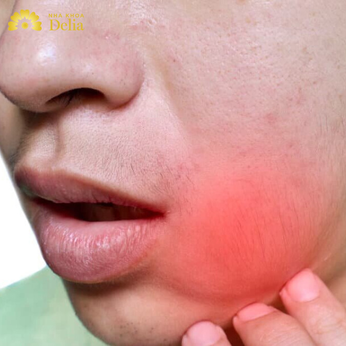 Đau quai hàm – Nguyên nhân hậu quả và cách khắc phục nhanh nhất