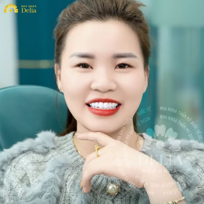 Chồng bắt vợ đi làm răng sứ và cái kết – Chị Hà Duyên