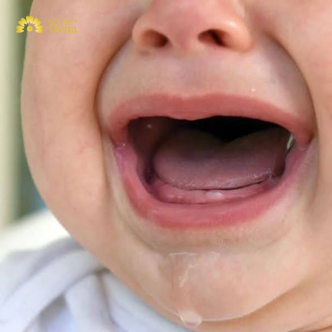 99+ Hình ảnh lợi trẻ sắp mọc răng cửa bố mẹ nên lưu ý