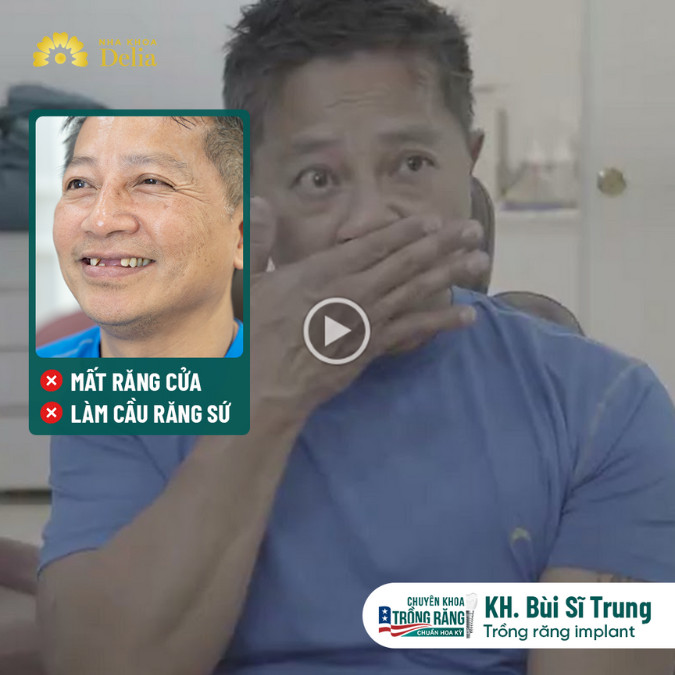Mất răng từ nhỏ, đến tứ tuần mới đi làm lại răng – Kiều bào Bùi Sĩ Trung