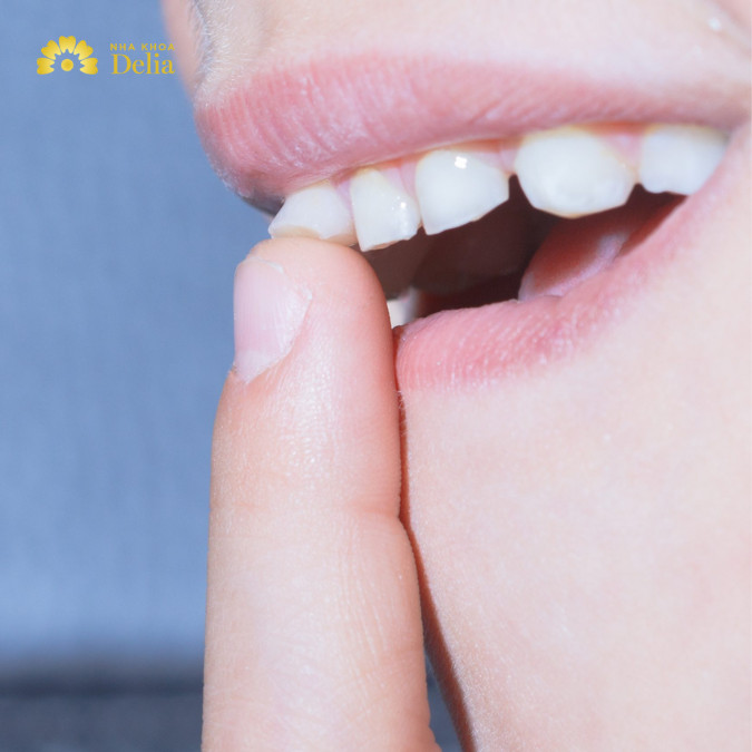 Răng lung lay làm sao để chắc lại? Giải pháp từ chuyên gia