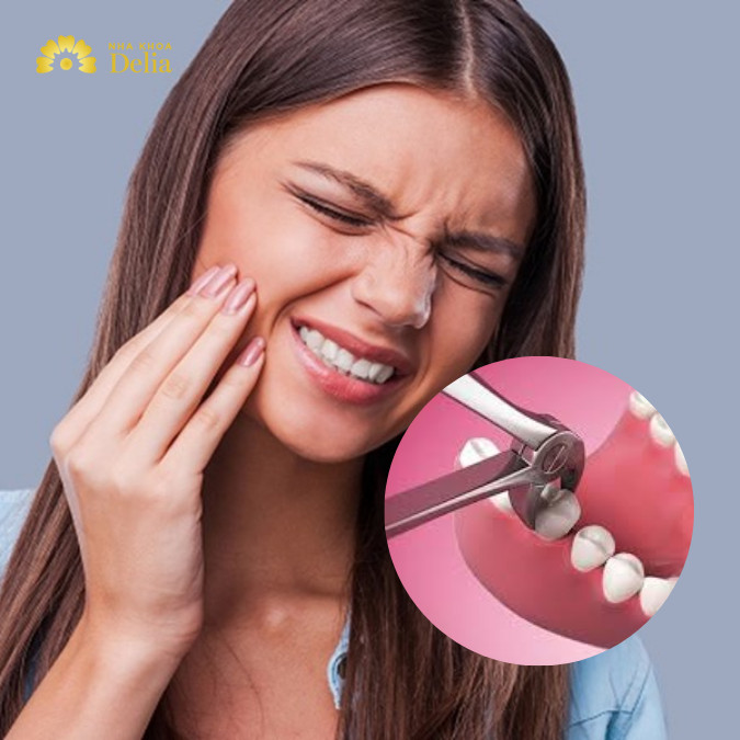 Răng sâu đang đau có nhổ được không? Lắng nghe lời khuyên từ chuyên gia