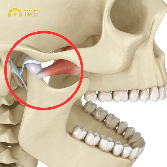 Rối loạn khớp thái dương hàm có nguy hiểm không, chữa thế nào?