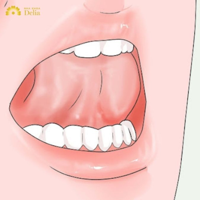 Mewing đúng cách sai cách mà người mới bắt đầu nên biết