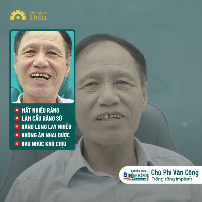 Trồng răng Implant – U70 ăn uống như thanh niên – KH chú Phí Văn Cộng
