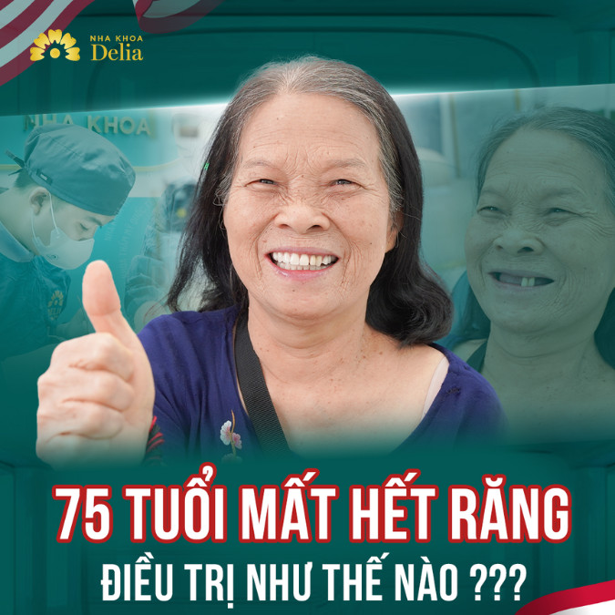 U80 đi trồng răng Implant theo lời con dâu và cái kết – Bác Nguyễn Thị Thạch