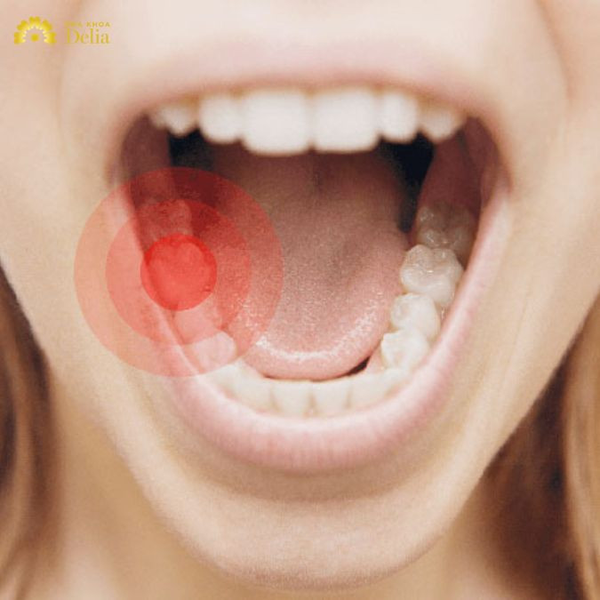 5 Cách giảm đau răng hàm nhanh chóng, an toàn, hiệu quả