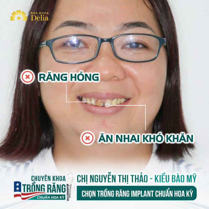 Cực SỐC: Kiều bào Mỹ đưa cả gia đình về Việt Nam trồng răng – KH Nguyễn Thị Thảo