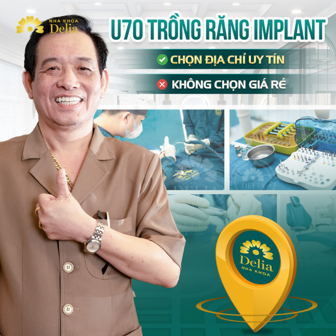 Cấy ghép Implant Hàn Quốc có tốt không? Giá bao nhiêu – Cập nhật 2024
