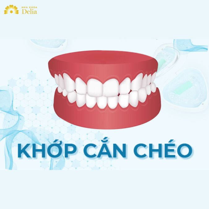 Bỏ qua khớp cắn chéo, đối diện với những hiểm họa khôn lường
