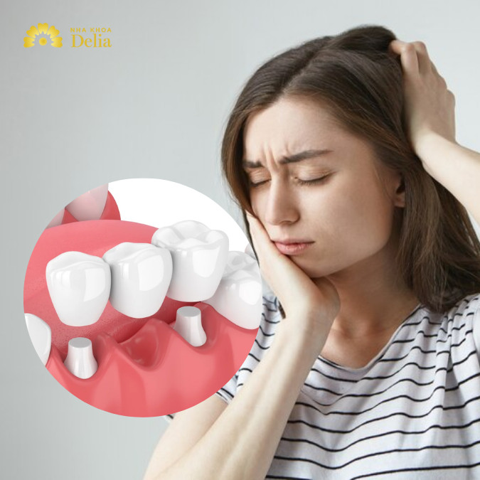 Làm cầu răng sứ có đau không? Lời giải đáp chi tiết từ chuyên gia