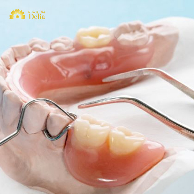 Răng giả tháo lắp 2 chiếc có bền không, có nên sử dụng không?