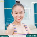 Đến Delia với tâm lý lo lắng, chị Hương đã trải qua 2 buổi làm răng nhẹ nhàng, không đau đớn
