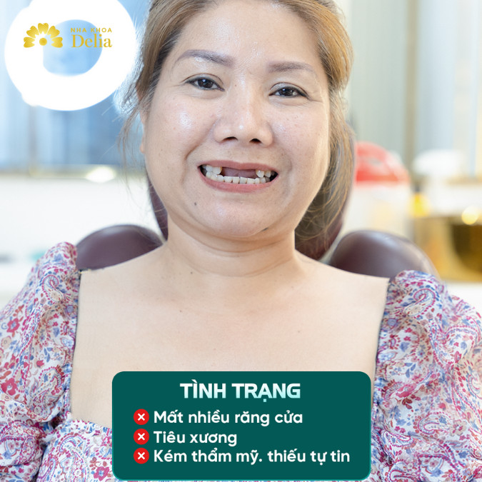Nha khoa Delia – Nha khoa thẩm mỹ quốc tế lớn nhất Việt Nam có gì?