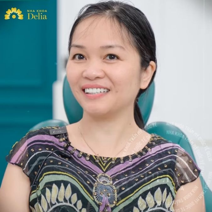 Thay đổi ngoạn mục sau khi làm răng sứ – KH Bùi Thuỷ