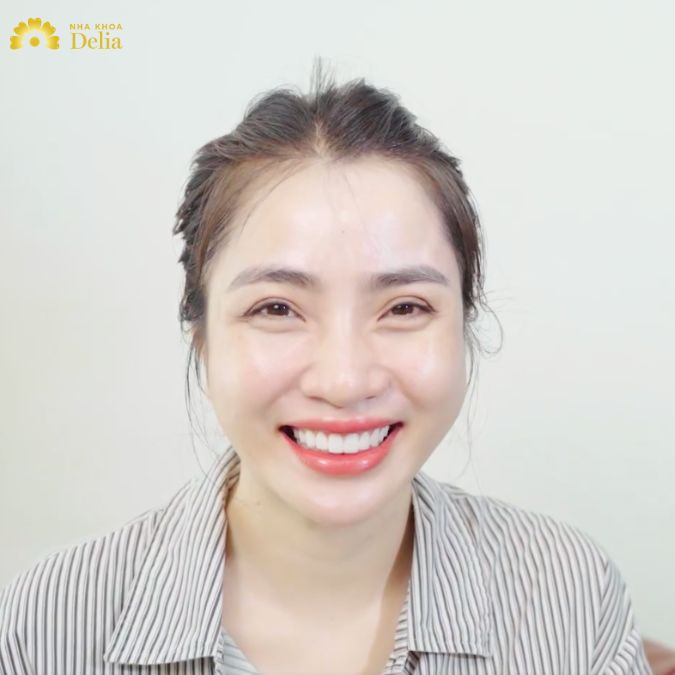 Không tin tưởng nha khoa Thanh Hóa ngoài Delia – KH Lê Toàn