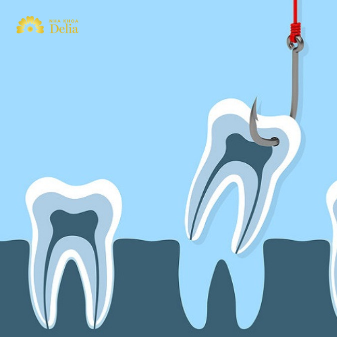 Giải đáp: Nhổ răng số 5 có mọc lại không?