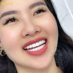 phụ nữ sở hữu dáng răng rồng thường gặp nhiều thuận lợi trong sự nghiệp