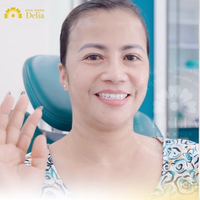 Lột xác sau khi thẩm mỹ răng sứ tại Delia – KH Đỗ Tâm