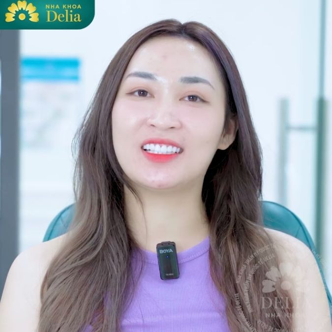 Tụt lợi, răng xấu KH Thuỳ Dương quyết định đến Delia bọc sứ