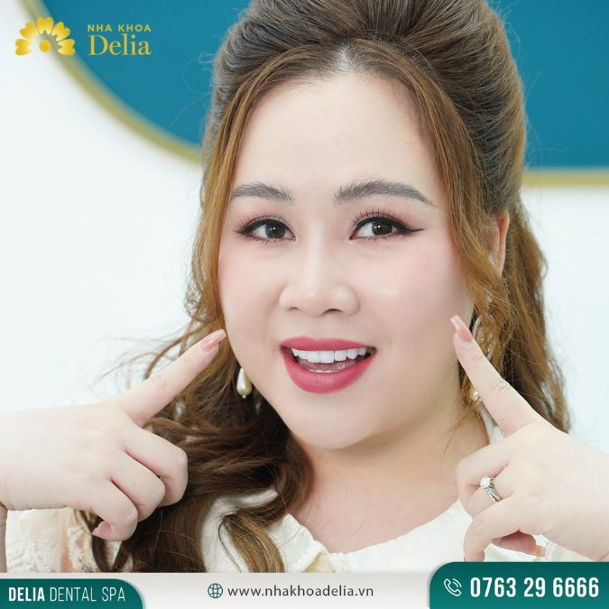 Diễn viên Trương Phương là ai? Trương Phương bọc răng sứ ở đâu?