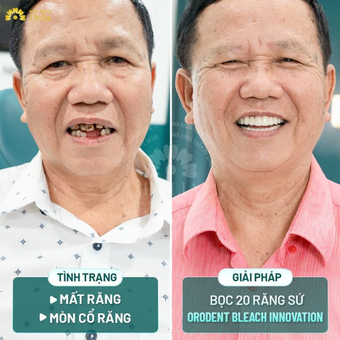 Hành trình đi tìm nụ cười mới cho ba của diễn viên Anh Đức