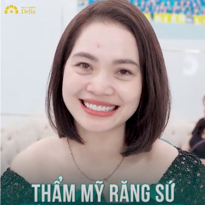 Nhan sắc thăng hạng sau thẩm mỹ răng sứ tại Delia – KH Hương