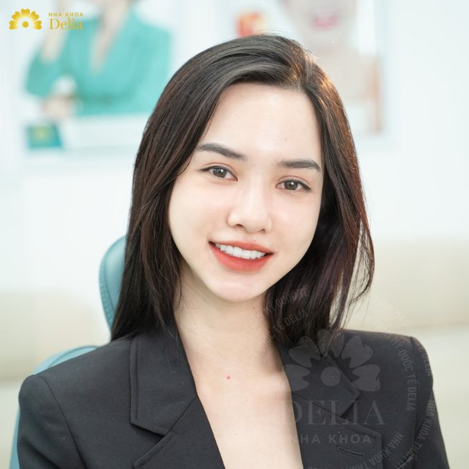Có nên chọn ngày đẹp làm răng sứ không? Yếu tố quyết định làm răng sứ thành công?