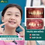 Nha khoa Delia - Địa chỉ niềng răng chỉnh nha không đau
