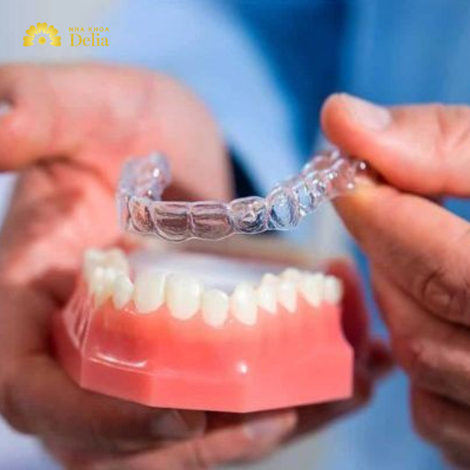 7 địa chỉ niềng răng trong suốt Cần Thơ cực uy tín