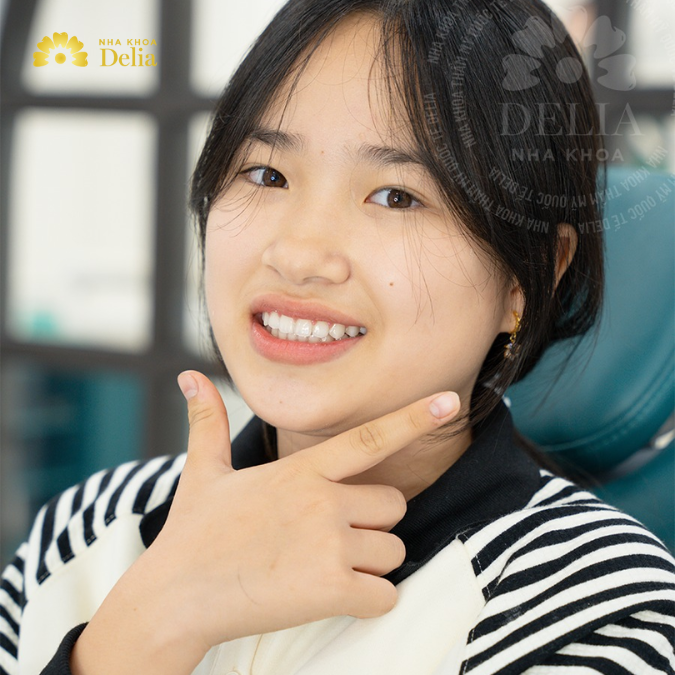 Niềng răng trong suốt ở đâu tốt nhất, địa chỉ nào uy tín?