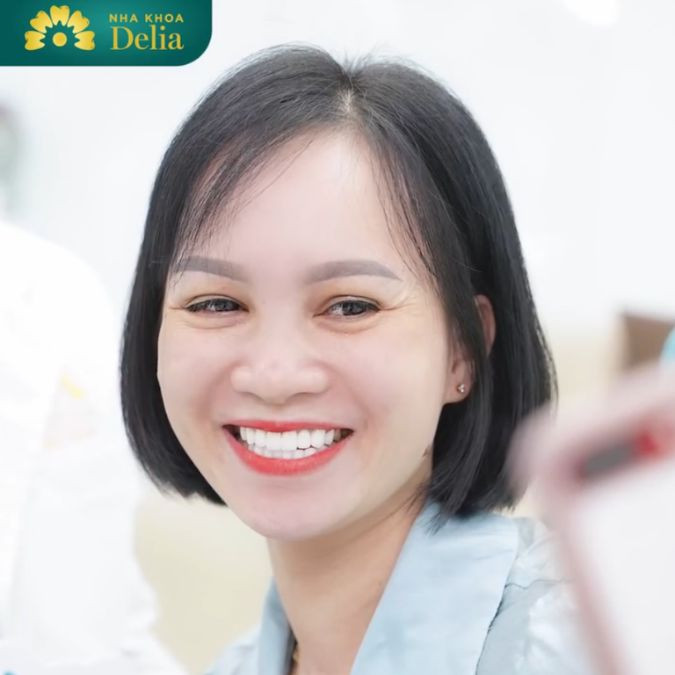 Quyết định làm răng sứ sau 5 năm xem live – KH Thanh Hương