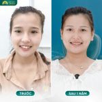 Chị Hà - Giáo viên