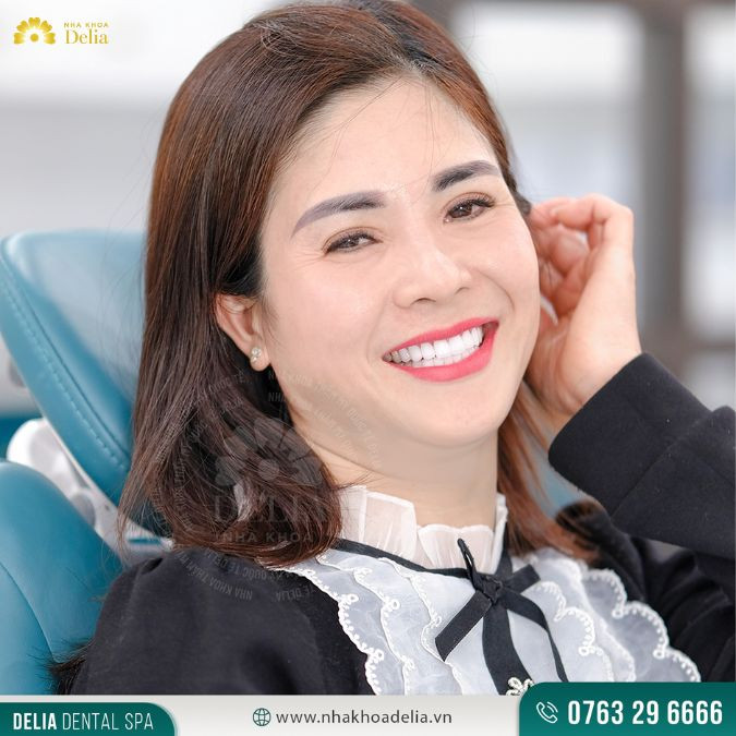 Răng sứ Diamond S – Kết tinh từ đôi bàn tay của nghệ nhân
