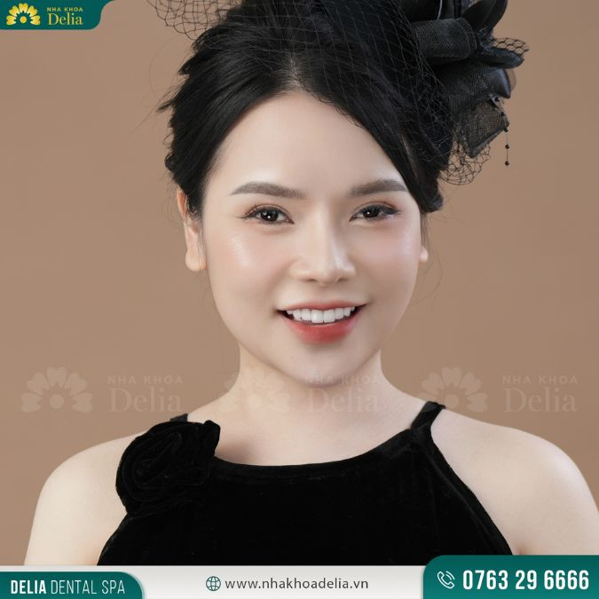 Delia – Địa chỉ bọc răng sứ Diamond uy tín nhất năm 2024