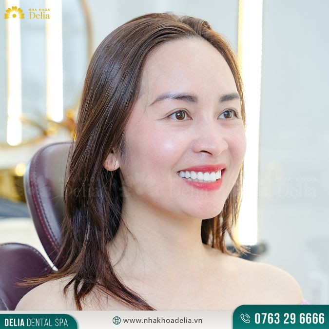 Bảng giá nha khoa thẩm mỹ quốc tế Delia: Chi tiết, mới nhất 2024